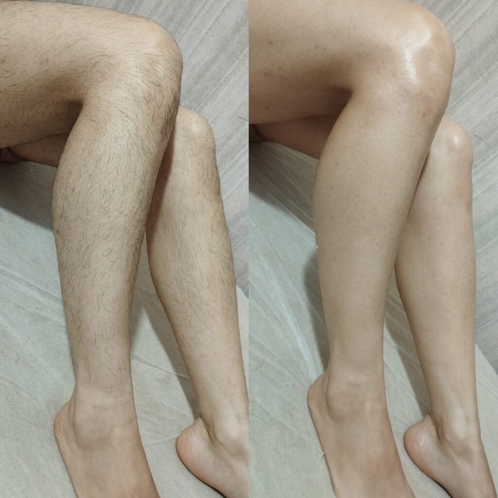 Serviços de Depilação – Cuidado, Beleza e Bem-Estar